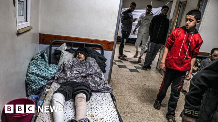 Gaza doctors give their own blood patients after scores gunned down seeking aid