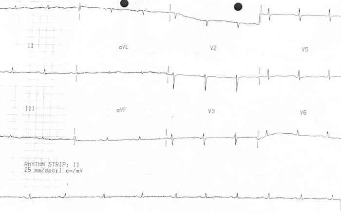 Weak chinese demand leaves australia with too much wheat